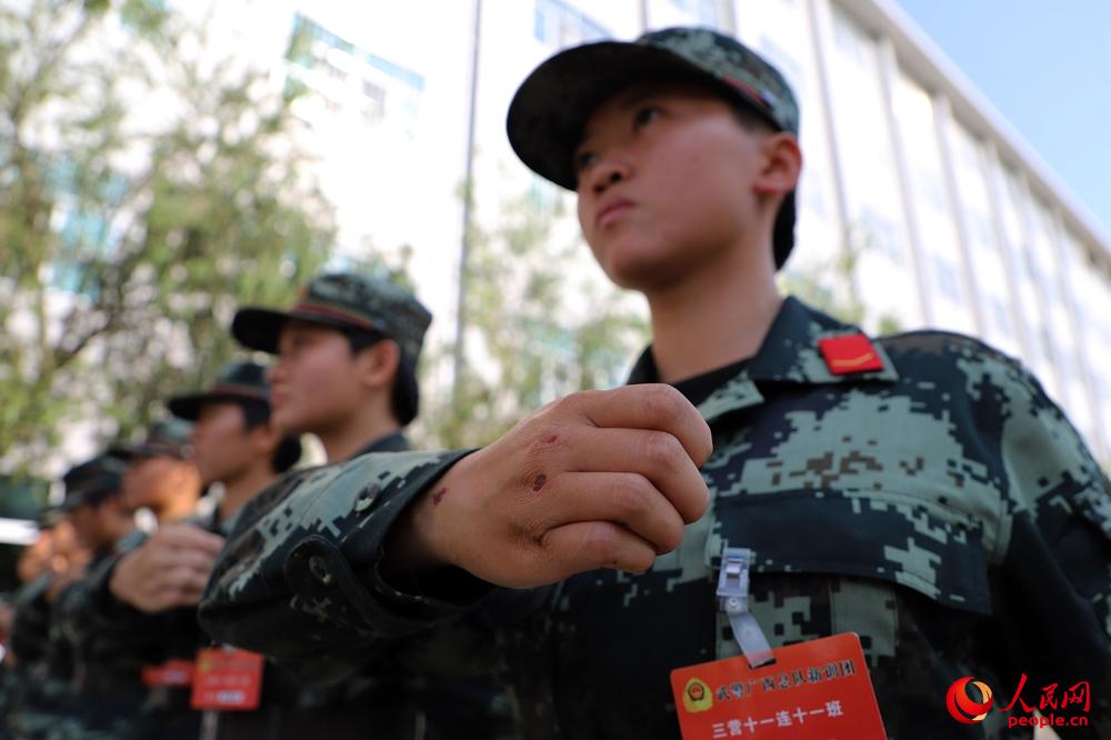 2018年11月27日，一名武警女兵训练中，手上的伤痕体现出“女汉子”风范。